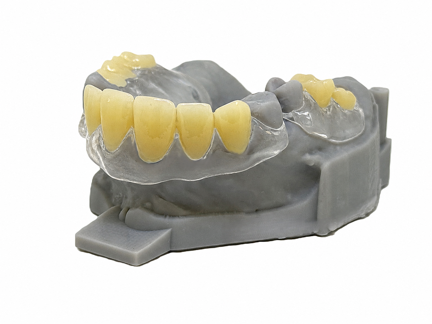 Flexible To Finish With Model – GPS Digital RPD
