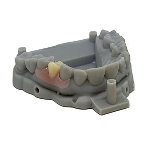 Flexible One Tooth Nesbit to finish with Model