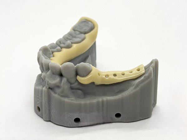 Zirlux Acetal Partial Frame with Model