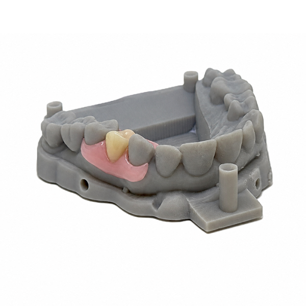 Flexible One Tooth Nesbit to finish with Model – GPS Digital RPD