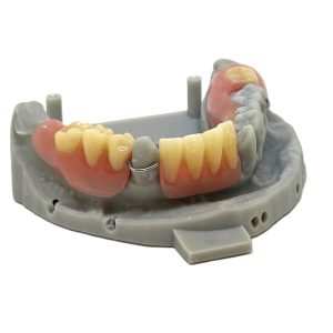 Lucitone Digital Print Partial with Model